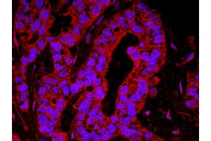 Immunofluorescence (IF) image for anti-Yes-Associated Protein 1 (YAP1) (AA 350-400) antibody (ABIN7449039)
