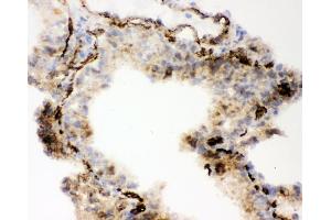 IHC analysis of ACE using anti-ACE antibody (ABIN3043777).