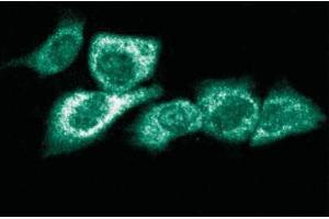 Immunofluorescent staining of Hs 766T cells. (RPS6KA1 Antikörper  (AA 1-184))