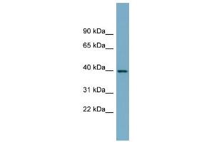 WB Suggested Anti-SULT2B1 Antibody Titration:  0. (SULT2B1 Antikörper  (N-Term))