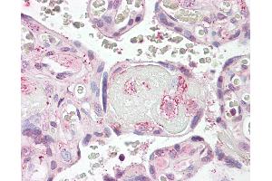 Anti-LYN antibody IHC of human placenta. (LYN Antikörper  (AA 39-58))