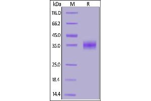 SARS S protein RBD, His Tag on SDS-PAGE under reducing (R) condition.