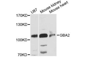 Western blot analysis of extracts of various cell lines, using GBA2 antibody (ABIN6292695) at 1:3000 dilution. (GBA2 Antikörper)