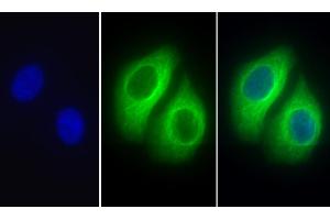 Detection of TUBb in Human Hela cell using Polyclonal Antibody to Tubulin Beta (TUBb) (TUBB Antikörper  (AA 170-419))