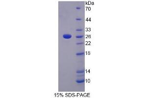 SDS-PAGE analysis of Human LRP3 Protein. (LRP3 Protein)