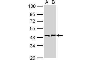 WB Image Sample (30 ug of whole cell lysate) A: A431 , B: H1299 10% SDS PAGE antibody diluted at 1:1000 (GMDS Antikörper)