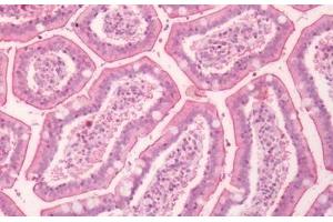 Human Small Intestine: Formalin-Fixed, Paraffin-Embedded (FFPE) (F2RL1 Antikörper  (C-Term))