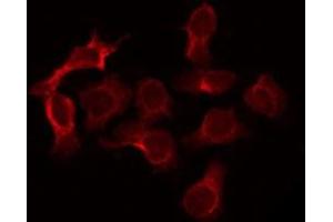 Immunofluorescence (fixed cells) (IF/ICC) image for anti-Tumor Necrosis Factor (Ligand) Superfamily, Member 13 (TNFSF13) (Internal Region) antibody (ABIN6265449)