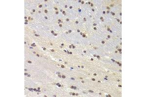 Immunohistochemistry (Paraffin-embedded Sections) (IHC (p)) image for anti-PRP3 Pre-mRNA Processing Factor 3 Homolog (PRPF3) (AA 1-280) antibody (ABIN6146260)