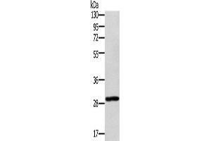 Western Blotting (WB) image for anti-Ectodysplasin A2 Receptor (EDA2R) antibody (ABIN2423350) (Ectodysplasin A2 Receptor Antikörper)