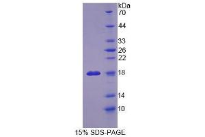 SDS-PAGE (SDS) image for Osteopetrosis Associated Transmembrane Protein 1 (OSTM1) (AA 120-251) protein (His tag) (ABIN6239190)