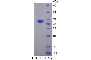 SDS-PAGE analysis of Human UBE2S Protein. (UBE2S Protein)