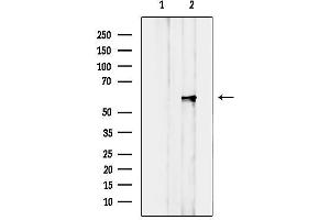 Western blot analysis of lysates from Jurkat cells, using Cytochrome P450 2V2 Antibody. (Cytochrome P450 2A6V2 (C-Term) Antikörper)