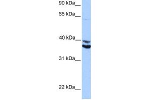WB Suggested Anti-MDFIC Antibody Titration:  0. (MDFIC Antikörper  (Middle Region))