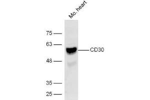 Western Blotting (WB) image for anti-Tumor Necrosis Factor Receptor Superfamily, Member 8 (TNFRSF8) (AA 51-150) antibody (ABIN1385704)
