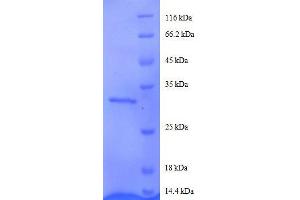SDS-PAGE (SDS) image for Agouti Related Protein Homolog (Mouse) (AGRP) (AA 83-132), (partial) protein (GST tag) (ABIN1046485)