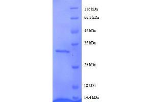 Agouti Related Protein Homolog (Mouse) (AGRP) (AA 83-132), (partial) protein (GST tag)