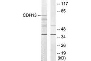 Western Blotting (WB) image for anti-Cadherin 13 (CDH13) (AA 331-380) antibody (ABIN2889875) (Cadherin 13 Antikörper  (AA 331-380))