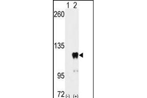 Western blot analysis of PUM2 (arrow) using PUM2 Antibody  (ABIN392131 and ABIN2841870). (PUM2 Antikörper  (AA 159-189))