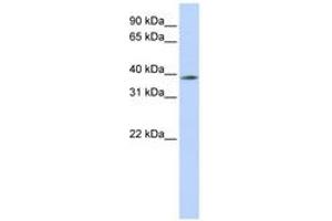 Image no. 1 for anti-Methyl-CpG Binding Domain Protein 2 (MBD2) (N-Term) antibody (ABIN6742279)
