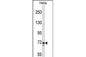 GALNT6 Antibody (C-term) (ABIN1537465 and ABIN2848506) western blot analysis in Hela cell line lysates (35 μg/lane). (GALNT6 Antikörper  (C-Term))