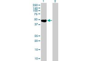 Western Blot analysis of OSMR expression in transfected 293T cell line by OSMR MaxPab polyclonal antibody. (Oncostatin M Receptor Antikörper  (AA 1-342))