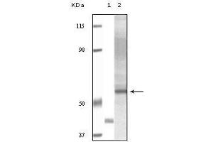 Western blot analysis using Akt3 mouse mAb against truncated Akt3 recombinant protein (1) and human ovary carcinoma tissue lysate (2).