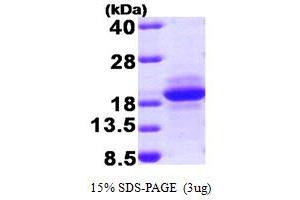 MCFD2 Protein (AA 27-146) (T7 tag)