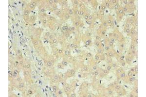 Immunohistochemistry of paraffin-embedded human liver using  in 30 μg/mL dilute concentrations. (CRP Antikörper)