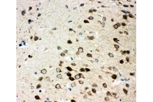 Immunohistochemistry (IHC) image for anti-Integrin, alpha 3 (ITGA3) (N-Term) antibody (ABIN3031394)
