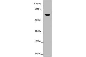 Western blot All lanes: CERKL antibody at 14 μg/mL + Mouse lung tissue Secondary Goat polyclonal to rabbit IgG at 1/10000 dilution Predicted band size: 63, 60, 53, 48, 43, 25, 20, 58 kDa Observed band size: 63 kDa (CERKL Antikörper  (AA 1-558))