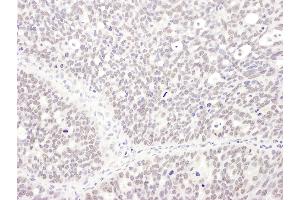 anti-Methylphosphate Capping Enzyme (MEPCE) (AA 639-689) antibody