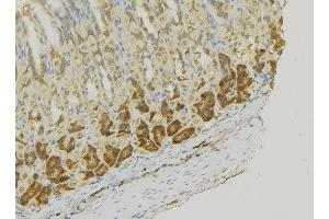 ABIN6273356 at 1/100 staining Human gastric tissue by IHC-P. (MCF2L Antikörper  (Internal Region))