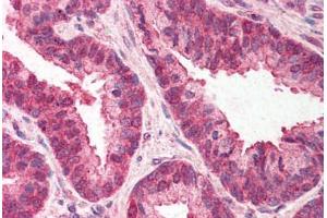 Human Prostate (formalin-fixed, paraffin-embedded) stained with TMED10 antibody ABIN214530 at 3 ng/ul followed by biotinylated goat anti-rabbit IgG secondary antibody ABIN481713, alkaline phosphatase-streptavidin and chromogen. (TMED10 Antikörper  (C-Term))