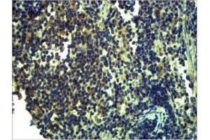 Immunohistochemical analysis of paraffin-embedded Mouse Spleen Tissue using TLR13 Polyclonal Antibody. (TLR13 Antikörper)