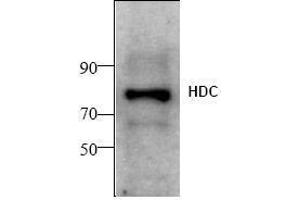 Image no. 1 for anti-Histidine Decarboxylase (HDC) antibody (ABIN155152) (HDC Antikörper)