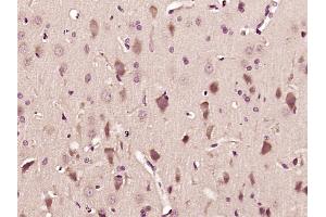 Paraformaldehyde-fixed, paraffin embedded Rat brain Antigen retrieval by boiling in sodium citrate buffer (pH6. (GABBR2 Antikörper  (AA 501-650))