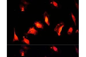 Immunofluorescence analysis of U-2 OS cells using MYST1 Polyclonal Antibody at dilution of 1:100 (40x lens). (MYST1 Antikörper)