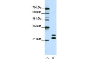 Western Blotting (WB) image for anti-Cold Shock Domain Containing C2, RNA Binding (CSDC2) antibody (ABIN2462255) (CSDC2 Antikörper)
