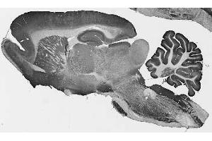 Adult rat brain immunohistochemistry. (CLCN3 Antikörper  (Cytosolic, N-Term))