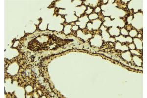 ABIN6273203 at 1/100 staining Mouse lung tissue by IHC-P. (C14orf166 Antikörper)