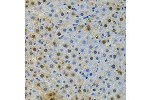 Immunohistochemistry of paraffin-embedded rat liver using BUB1 Antibody. (BUB1 Antikörper  (AA 1-300))