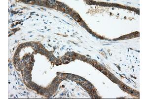 Image no. 6 for anti-Transforming, Acidic Coiled-Coil Containing Protein 3 (TACC3) antibody (ABIN1498098) (TACC3 Antikörper)