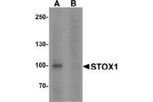 Western blot analysis of STOX1 in human liver tissue lysate with STOX1 antibody at 1 ug/ml in (A) the absence and (B) the presence of blocking peptide. (STOX1 Antikörper  (C-Term))