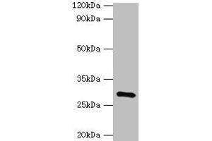 Western blot All lanes: GOSR1 antibody at 16 μg/mL + Mouse liver tissue Secondary Goat polyclonal to rabbit IgG at 1/10000 dilution Predicted band size: 29, 22 kDa Observed band size: 29 kDa (GS28 Antikörper  (AA 1-115))
