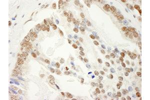 Immunohistochemistry (IHC) image for anti-KH Domain Containing, RNA Binding, Signal Transduction Associated 1 (KHDRBS1) (AA 1-50) antibody (ABIN7454806)