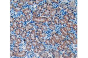 Used in DAB staining on fromalin fixed paraffin- embedded kidney tissue (BNP Antikörper  (AA 27-121))