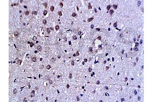Formalin-fixed and paraffin embedded rat brain tissue labeled Anti-C-Jun Polyclonal Antibody (ABIN671691), Unconjugated at 1:200, followed by conjugation to the secondary antibody and DAB staining (C-JUN Antikörper  (AA 31-331))
