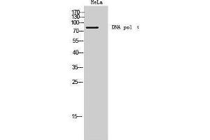 Western Blotting (WB) image for anti-DNA Polymerase I (C-Term) antibody (ABIN3174788) (DNA Polymerase I (C-Term) Antikörper)