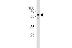Western Blotting (WB) image for anti-Activin Receptor Type I (ACRV1) (AA 132-162) antibody (ABIN3029855)